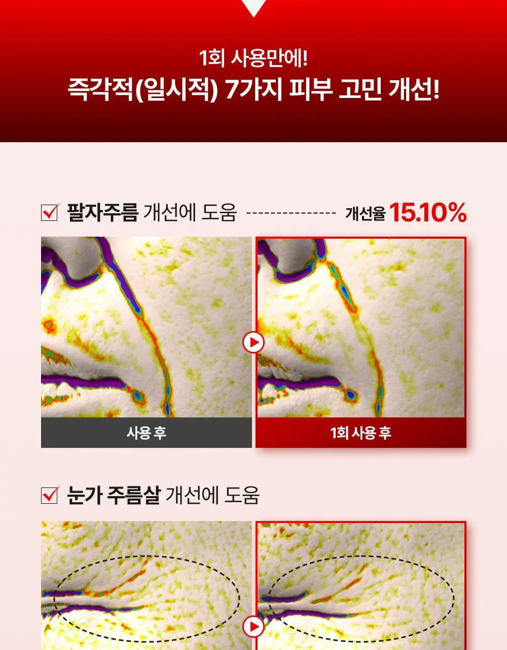 [기미잡티] 메디필 멜라논엑스 앰플 RX 30ml 상세페이지 17